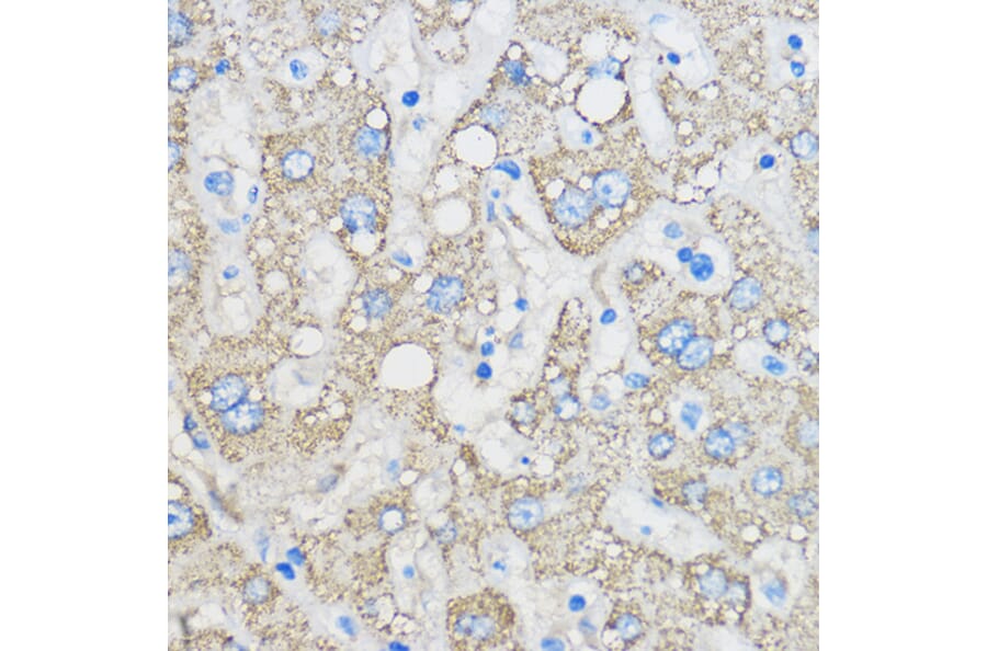 Immunohistochemistry - Anti-Chemerin Antibody (A15453) - Antibodies.com