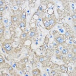 Immunohistochemistry - Anti-Chemerin Antibody (A15453) - Antibodies.com