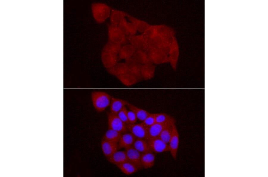Immunofluorescence - Anti-Chemerin Antibody (A15453) - Antibodies.com