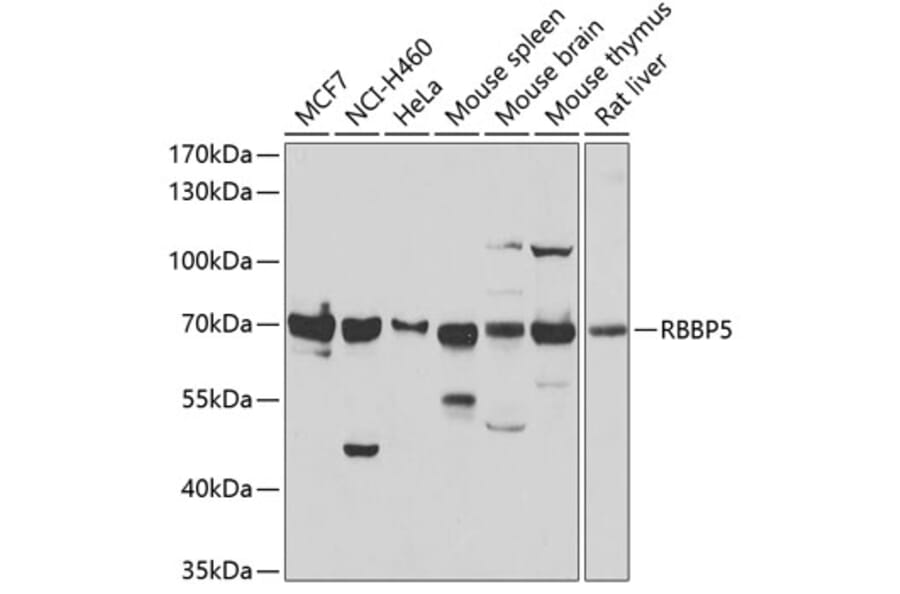 Western Blot - Anti-RbBP5 Antibody (A15454) - Antibodies.com