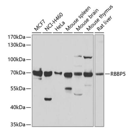 Western Blot - Anti-RbBP5 Antibody (A15454) - Antibodies.com