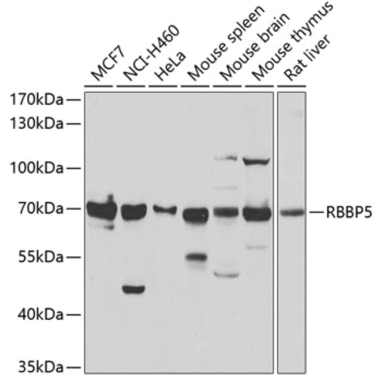 Western Blot - Anti-RbBP5 Antibody (A15454) - Antibodies.com