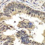 Immunohistochemistry - Anti-RbBP5 Antibody (A15454) - Antibodies.com