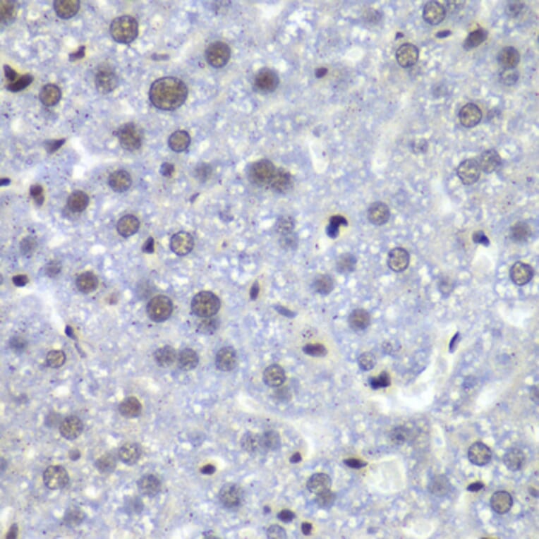 Immunohistochemistry - Anti-RbBP5 Antibody (A15454) - Antibodies.com