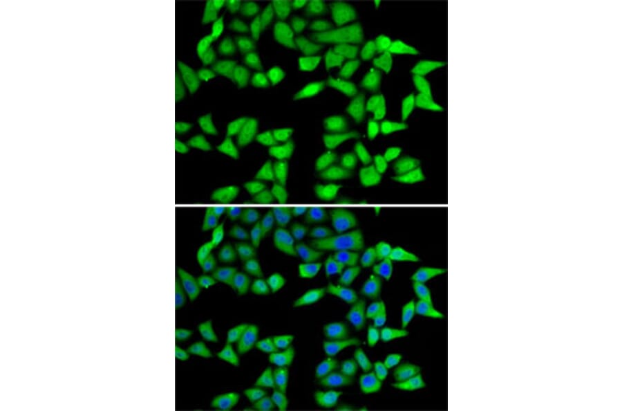 Immunofluorescence - Anti-RbBP5 Antibody (A15454) - Antibodies.com