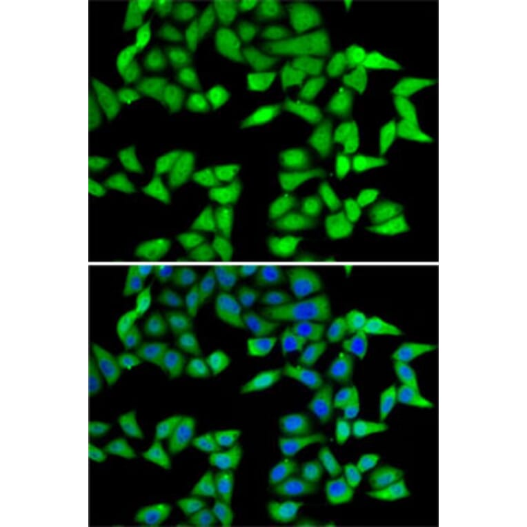 Immunofluorescence - Anti-RbBP5 Antibody (A15454) - Antibodies.com