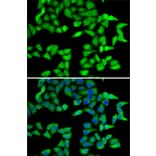 Immunofluorescence - Anti-RbBP5 Antibody (A15454) - Antibodies.com