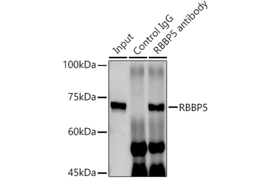 Western Blot - Anti-RbBP5 Antibody (A15454) - Antibodies.com