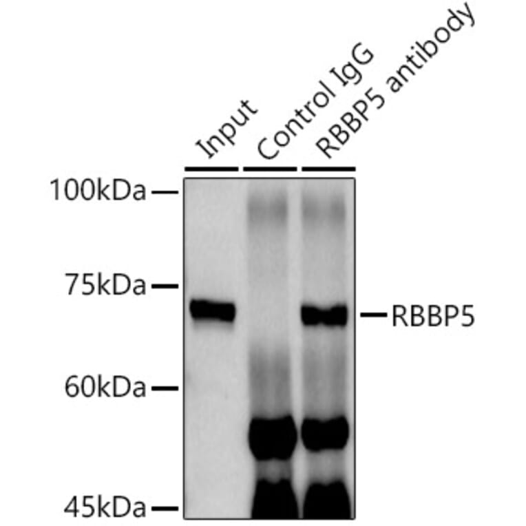 Western Blot - Anti-RbBP5 Antibody (A15454) - Antibodies.com