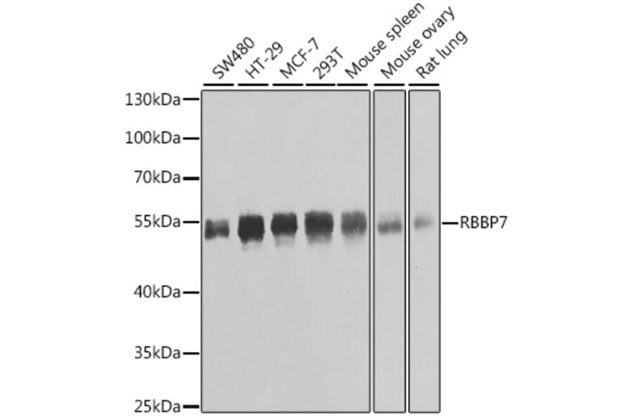 Western Blot - Anti-RBBP7 Antibody (A6967) - Antibodies.com