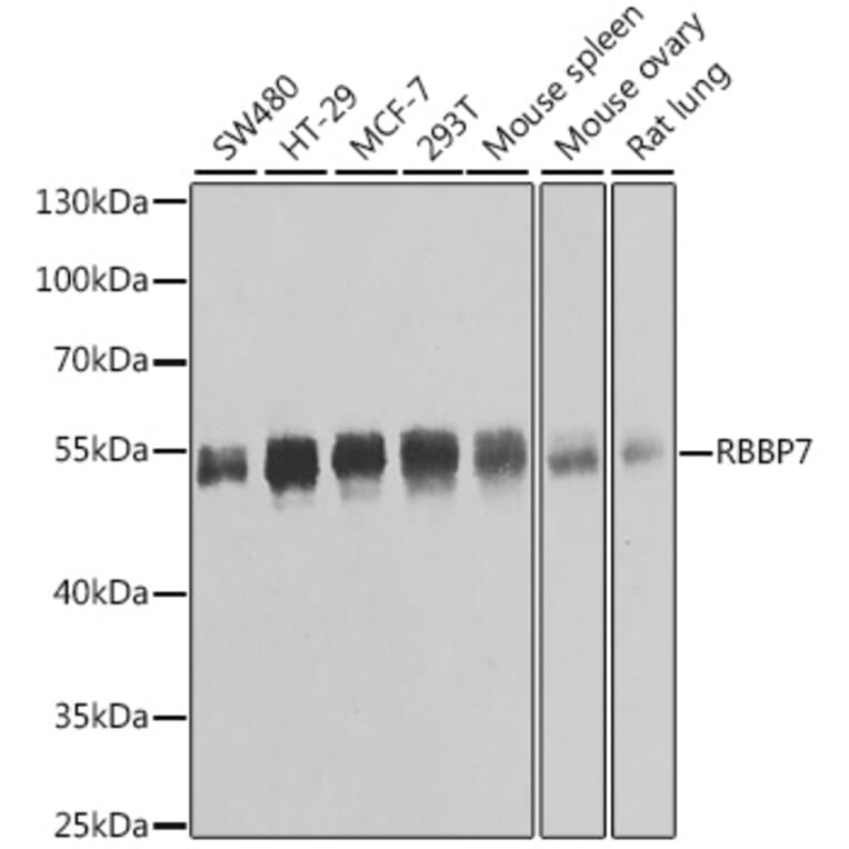 Western Blot - Anti-RBBP7 Antibody (A6967) - Antibodies.com