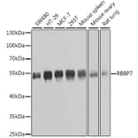 Western Blot - Anti-RBBP7 Antibody (A6967) - Antibodies.com
