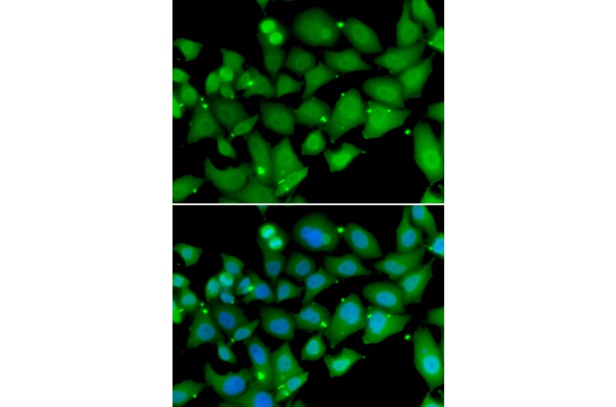 Immunofluorescence - Anti-RBBP7 Antibody (A6967) - Antibodies.com
