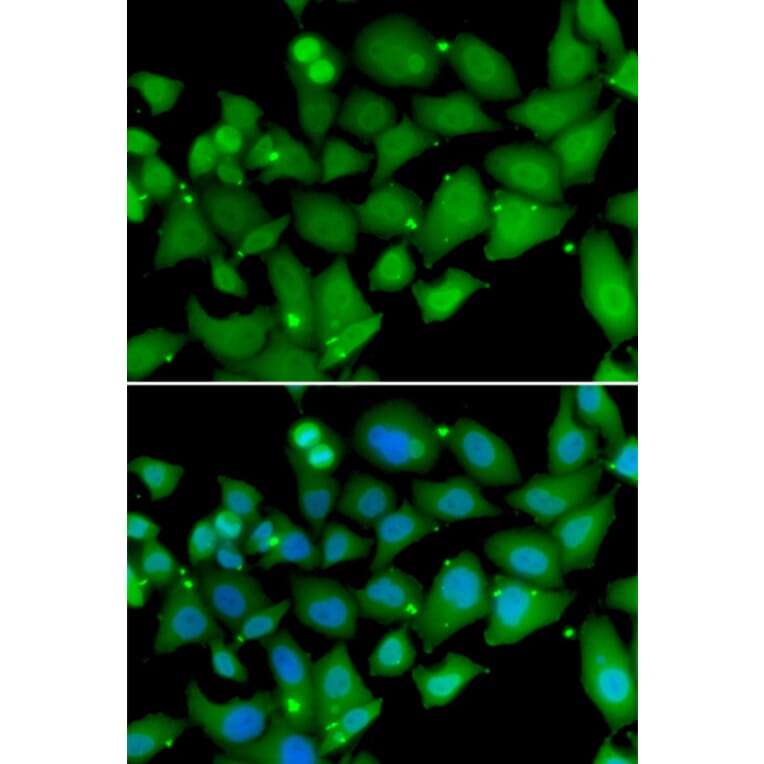 Immunofluorescence - Anti-RBBP7 Antibody (A6967) - Antibodies.com