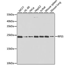 Western Blot - Anti-RPS5 Antibody (A15458) - Antibodies.com