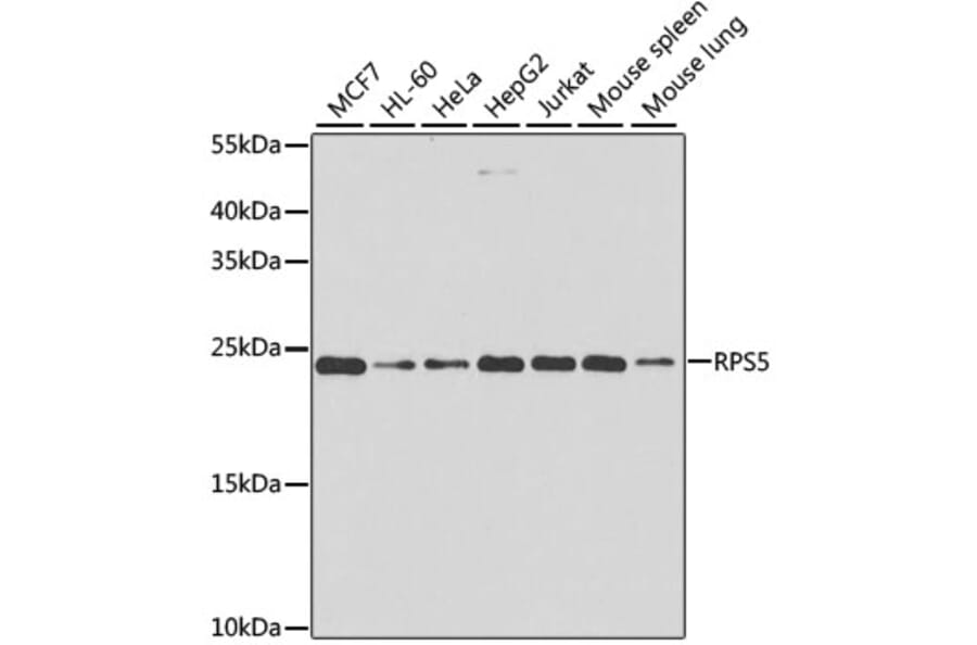 Western Blot - Anti-RPS5 Antibody (A15458) - Antibodies.com