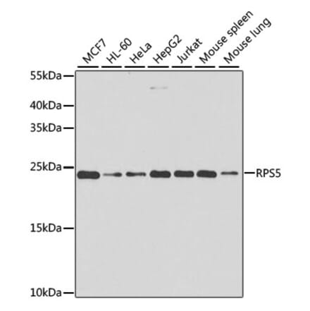 Western Blot - Anti-RPS5 Antibody (A15458) - Antibodies.com