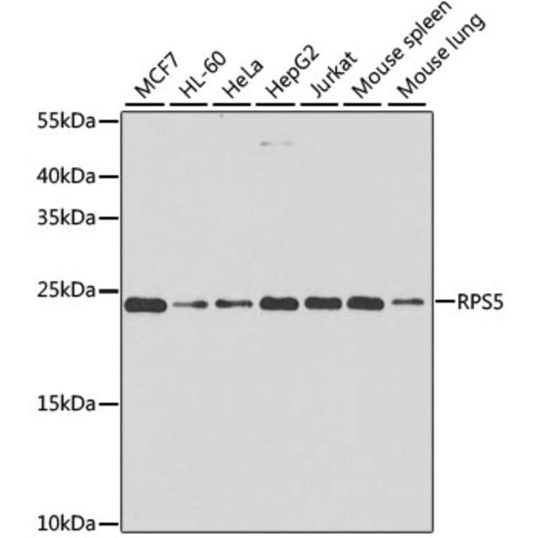 Western Blot - Anti-RPS5 Antibody (A15458) - Antibodies.com