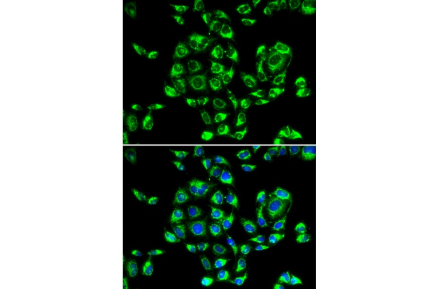 Immunofluorescence - Anti-RPS16 Antibody (A6976) - Antibodies.com
