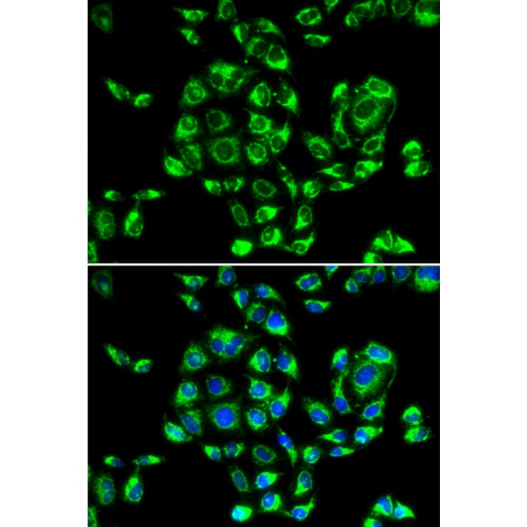 Immunofluorescence - Anti-RPS16 Antibody (A6976) - Antibodies.com