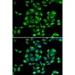 Immunofluorescence - Anti-RPS16 Antibody (A6976) - Antibodies.com