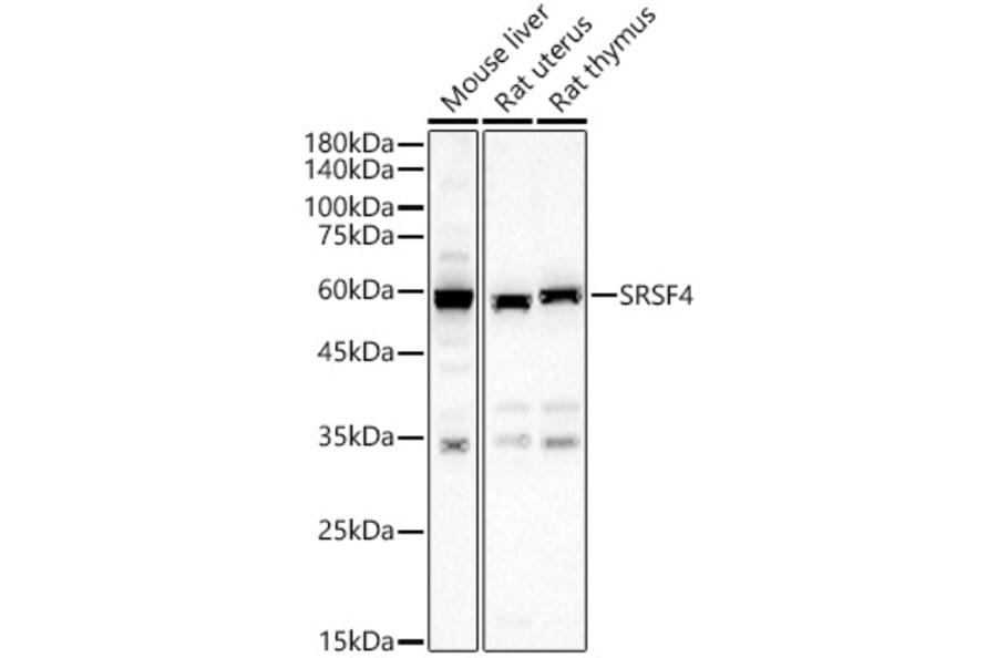 Western Blot - Anti-SFRS4/SRSF4 Antibody (A15460) - Antibodies.com