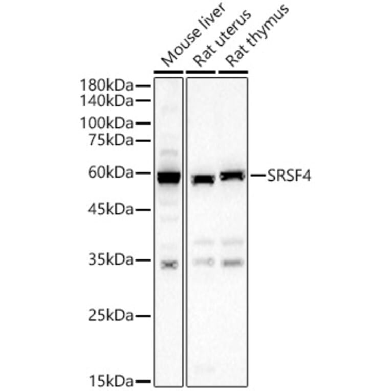 Western Blot - Anti-SFRS4/SRSF4 Antibody (A15460) - Antibodies.com