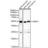 Western Blot - Anti-SFRS4/SRSF4 Antibody (A15460) - Antibodies.com