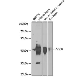 Western Blot - Anti-beta Sarcoglycan Antibody (A15461) - Antibodies.com