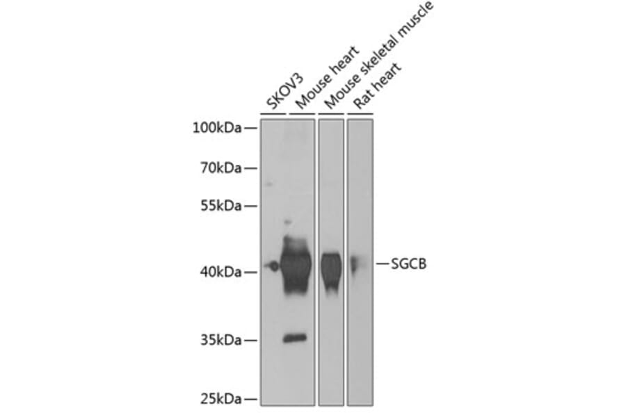 Western Blot - Anti-beta Sarcoglycan Antibody (A15461) - Antibodies.com