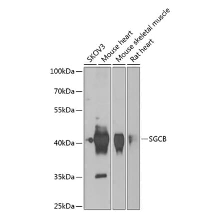 Western Blot - Anti-beta Sarcoglycan Antibody (A15461) - Antibodies.com