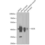 Western Blot - Anti-beta Sarcoglycan Antibody (A15461) - Antibodies.com