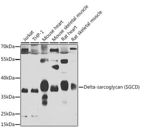 Western Blot - Anti-delta Sarcoglycan Antibody (A15462) - Antibodies.com