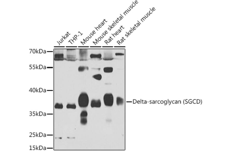 Western Blot - Anti-delta Sarcoglycan Antibody (A15462) - Antibodies.com