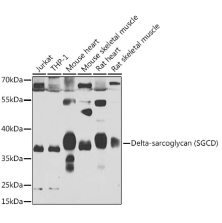 Western Blot - Anti-delta Sarcoglycan Antibody (A15462) - Antibodies.com