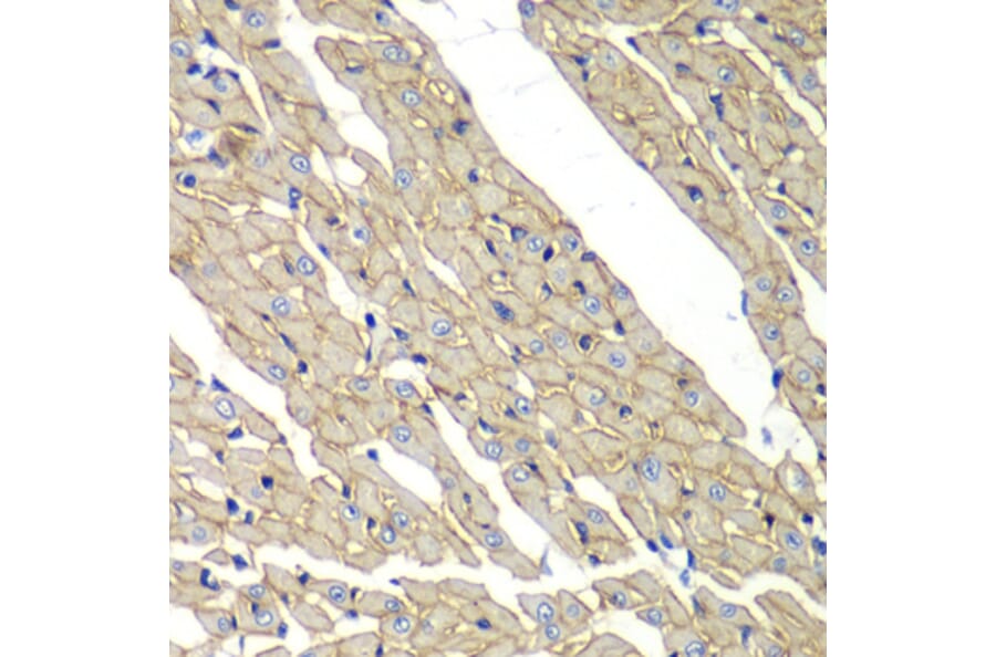 Immunohistochemistry - Anti-delta Sarcoglycan Antibody (A15462) - Antibodies.com