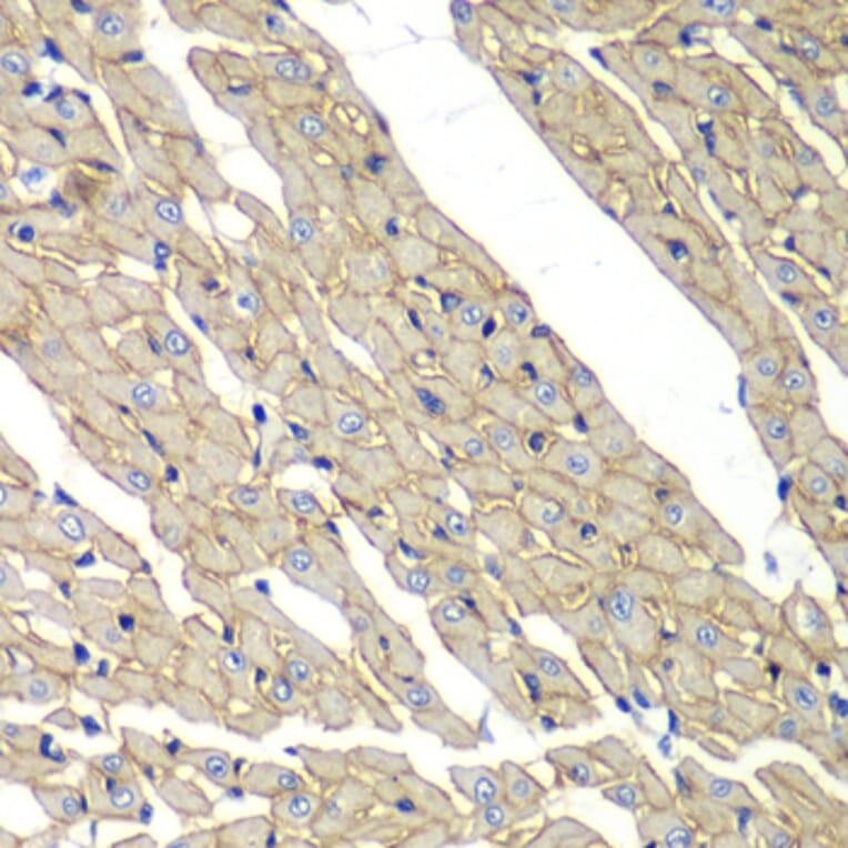 Immunohistochemistry - Anti-delta Sarcoglycan Antibody (A15462) - Antibodies.com