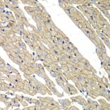 Immunohistochemistry - Anti-delta Sarcoglycan Antibody (A15462) - Antibodies.com