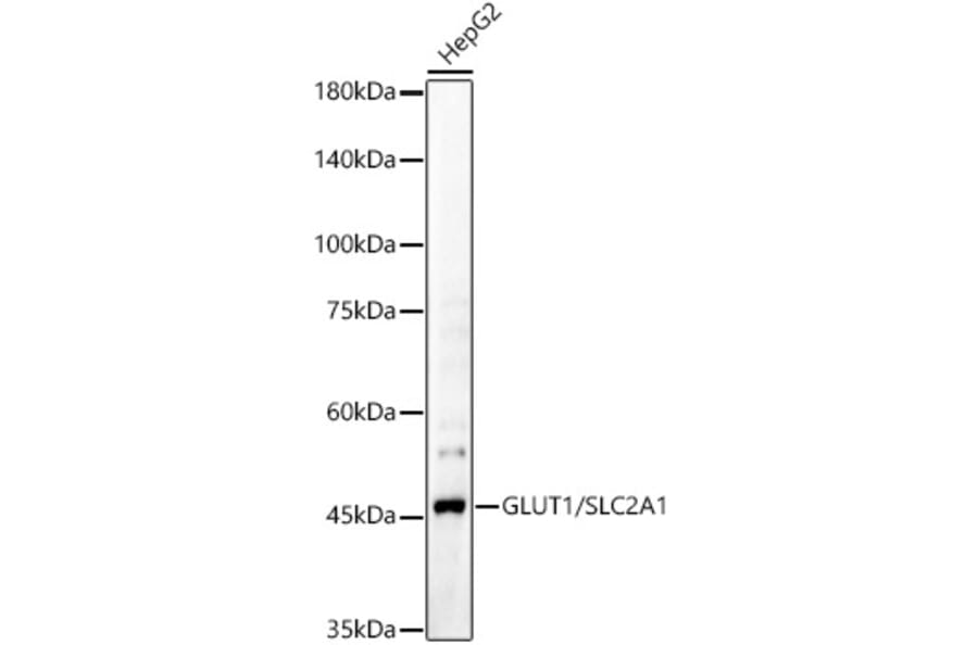 Western Blot - Anti-Glucose Transporter GLUT1 Antibody (A15463) - Antibodies.com