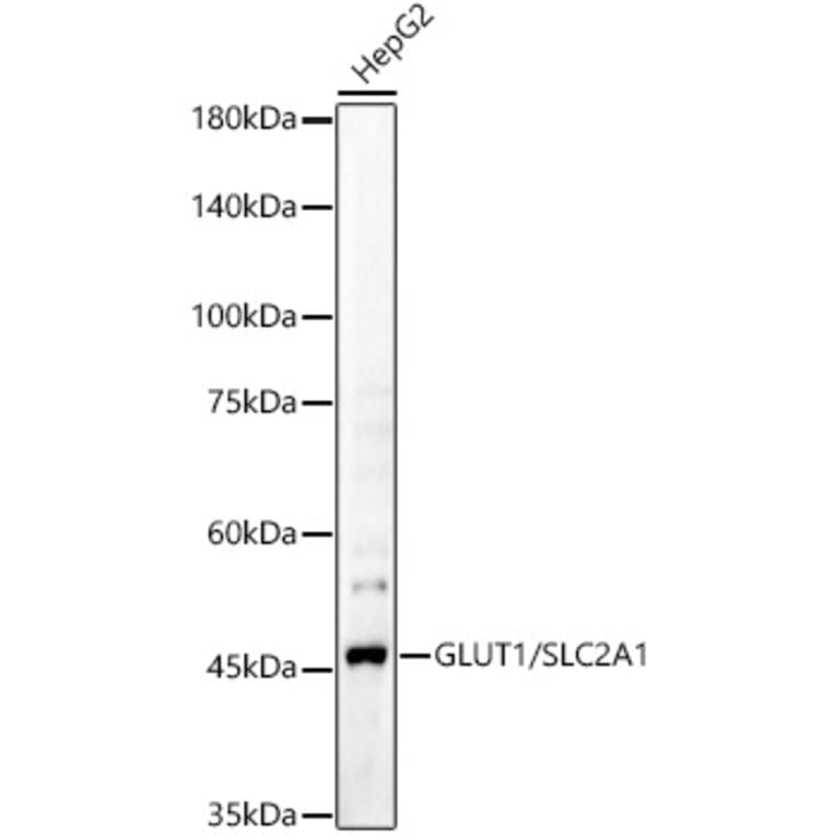 Western Blot - Anti-Glucose Transporter GLUT1 Antibody (A15463) - Antibodies.com