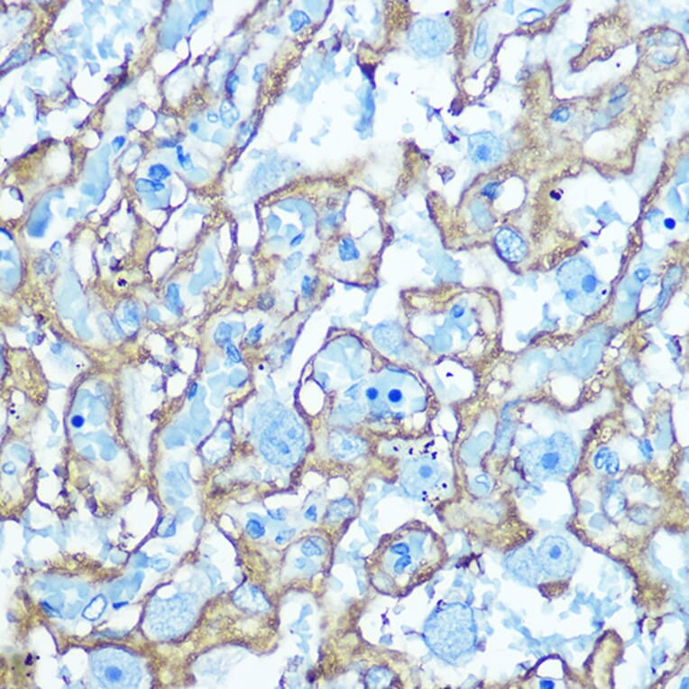 Immunohistochemistry - Anti-Glucose Transporter GLUT1 Antibody (A15463) - Antibodies.com