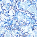 Immunohistochemistry - Anti-Glucose Transporter GLUT1 Antibody (A15463) - Antibodies.com