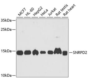 Western Blot - Anti-SNRPD2 Antibody (A15464) - Antibodies.com