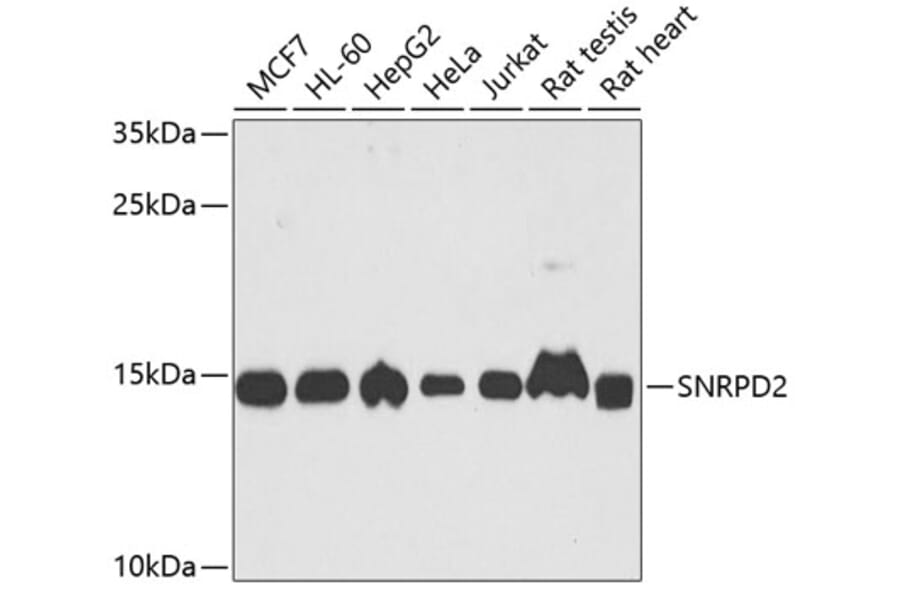 Western Blot - Anti-SNRPD2 Antibody (A15464) - Antibodies.com