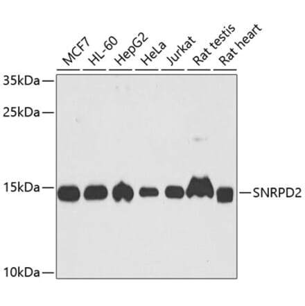 Western Blot - Anti-SNRPD2 Antibody (A15464) - Antibodies.com