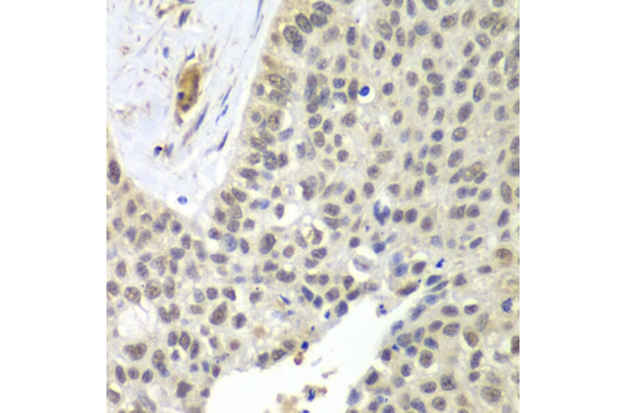 Immunohistochemistry - Anti-SNRPD2 Antibody (A15464) - Antibodies.com