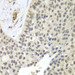 Immunohistochemistry - Anti-SNRPD2 Antibody (A15464) - Antibodies.com