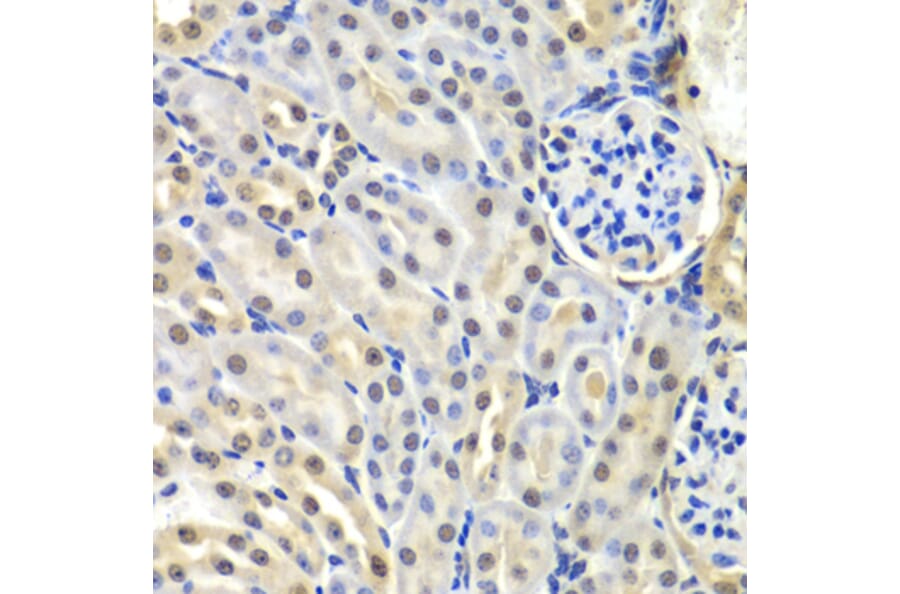 Immunohistochemistry - Anti-SNRPD2 Antibody (A15464) - Antibodies.com