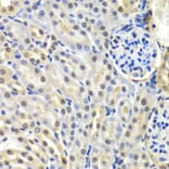 Immunohistochemistry - Anti-SNRPD2 Antibody (A15464) - Antibodies.com