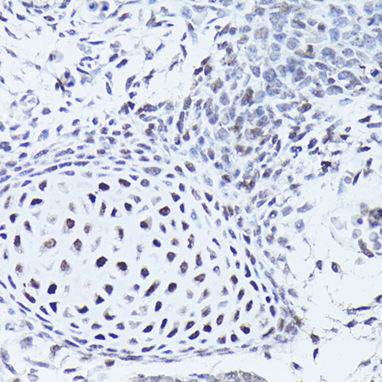 Immunohistochemistry - Anti-SOX5 Antibody (A15465) - Antibodies.com